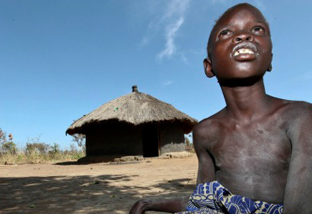 They Might Be Zombies: Strange “Nodding Disease” Zombifies Children in Uganda