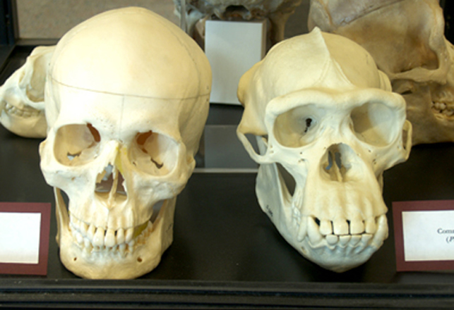 Why Do We Have Big Brains and Small Teeth?