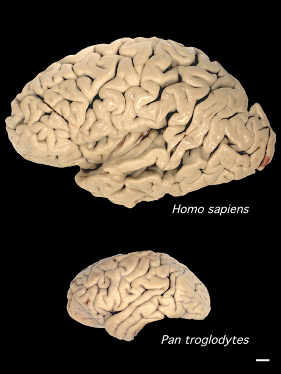 Human_and_chimp_brain