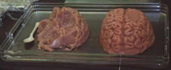 dish of brains