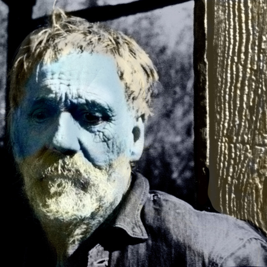 The “Blue Men” of Kentucky and Other Dermatological Oddities