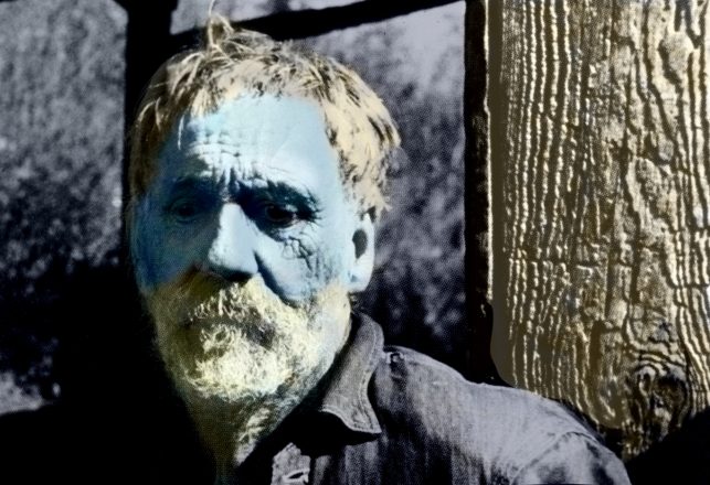 The “Blue Men” of Kentucky and Other Dermatological Oddities