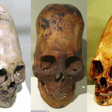 Elongated Skulls Could Have Been a Survival Aid