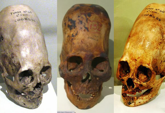 Elongated Skulls Could Have Been a Survival Aid
