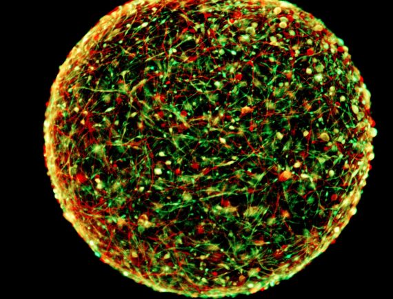a digital rendering of the mini brains grown at john hopkins 570x434