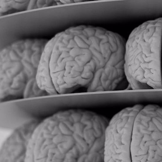 Scientists Have Created Tiny Human Brains for Drug Testing