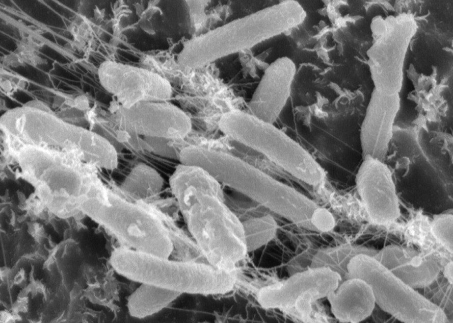 Plastic-Eating-Bacterium-889x633