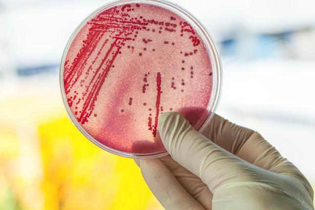 7 objetos de la vida diaria con mas bacterias de las que imaginas