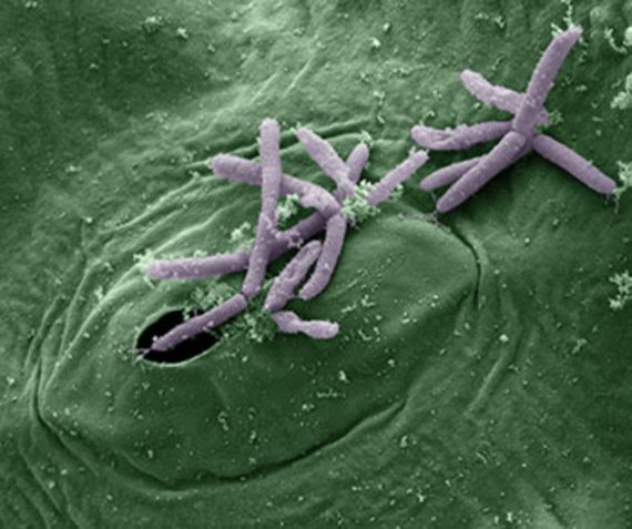 bacteris 570x477