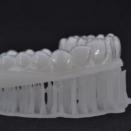3D Printer Fixes Teeth So You Can Eat 3D Printed Cheese