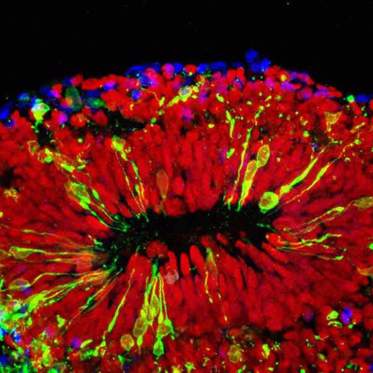 Mini-Brain Research Provides Evidence of Zika’s Effects