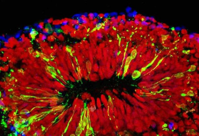Mini-Brain Research Provides Evidence of Zika’s Effects
