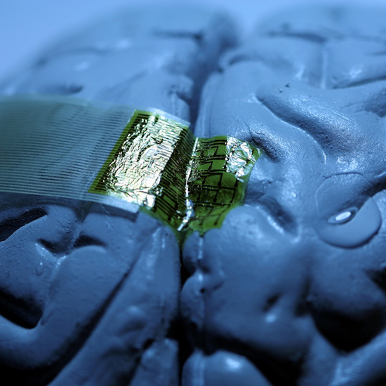 Paralyzed Man Regains Motor Control Through Brain Sensors