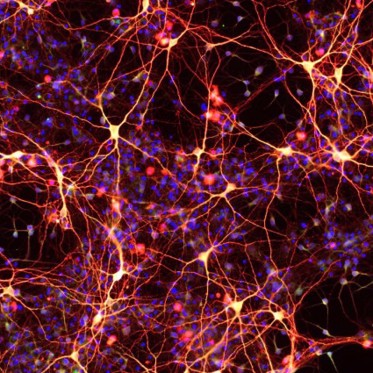 New Drug Treatment Turns Skin Cells into Brain Cells