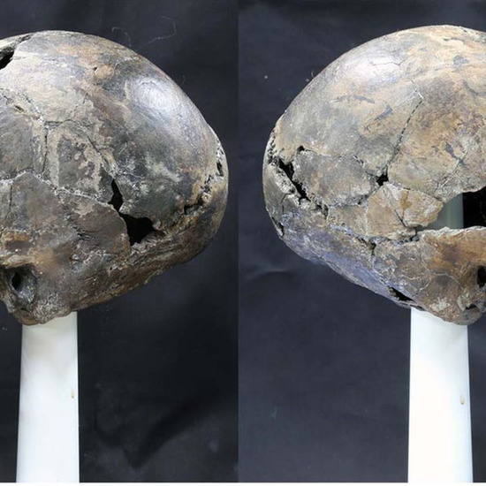 Ancient Long-Headed Skull from Korea was Naturally Formed