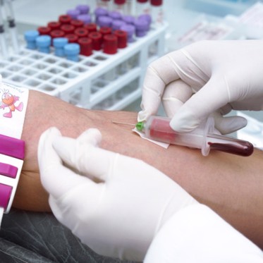 New Blood Test Accurately Detects Early Alzheimer’s