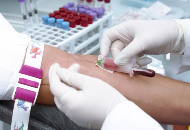 New Blood Test Accurately Detects Early Alzheimer’s