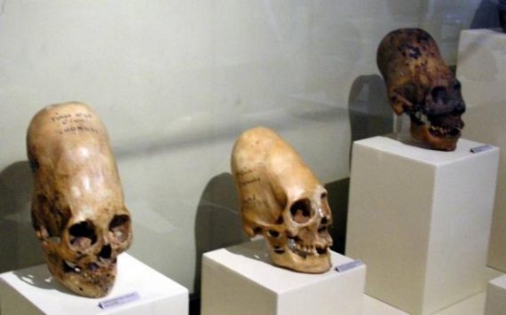 paracas skulls 0 570x355