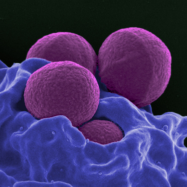 New MRSA-Fighting Antibiotic Discovered in Human Snot