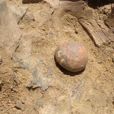 Ancient Skeleton Contains Huge 12,000-Year-Old Prostate Stone