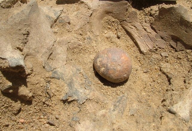 Ancient Skeleton Contains Huge 12,000-Year-Old Prostate Stone