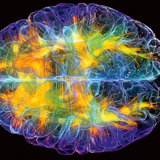 Study Shows Brains Are Ten Times More Active Than We Thought