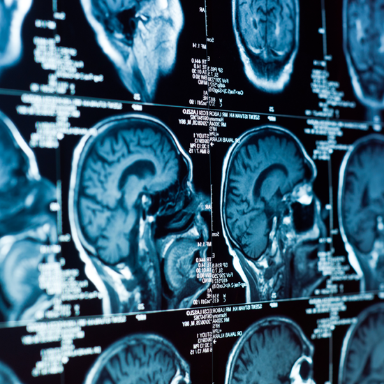 Doctors Report Cases of Anomalous Brain Activity After Death