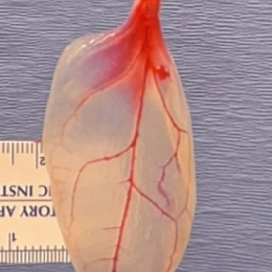 Spinach Leaves Used to Grow Human Heart