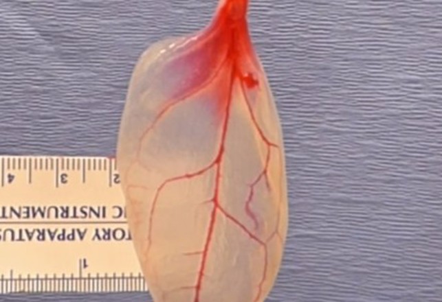Spinach Leaves Used to Grow Human Heart