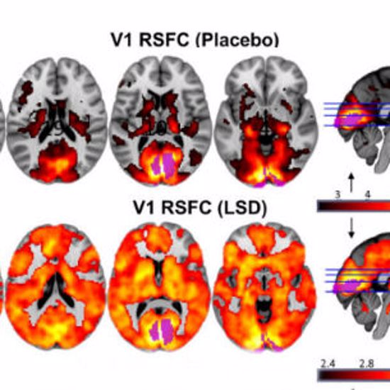 Brain Scans Prove Psychedelics Cause Higher Conscious State
