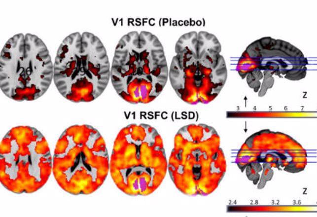 Brain Scans Prove Psychedelics Cause Higher Conscious State