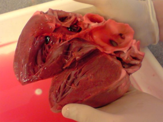 pig heart 570x428