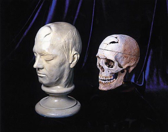 Phineas Gage life mask skull 2 570x449