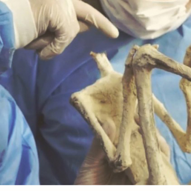 Mini Mummified 3-Fingered Humanoid Being Analyzed in Peru