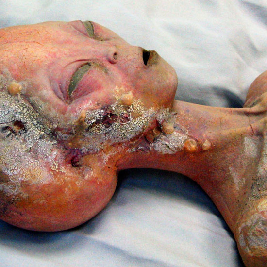 Another Alien Autopsy Photo From Roswell Revealed