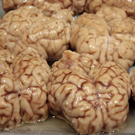 Advanced Brain Waves Detected in Lab-Grown Human Mini-Brains