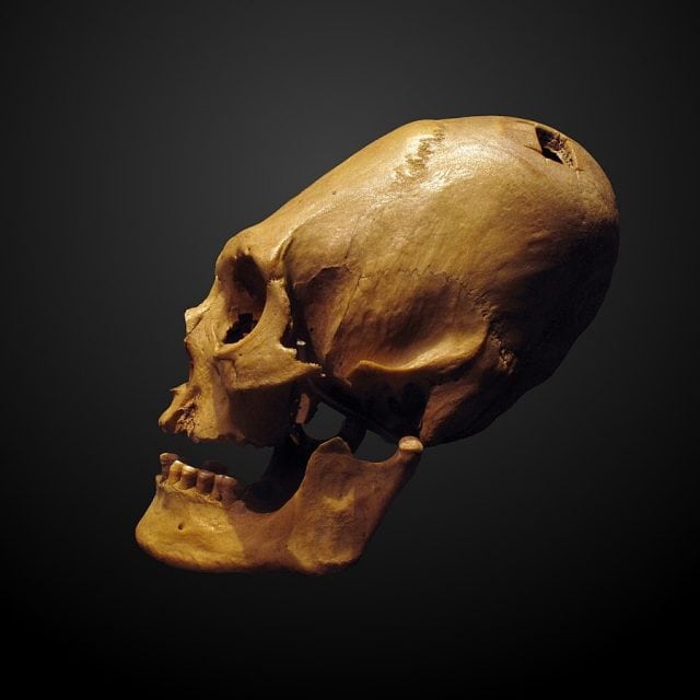 900px Deformed trepanated skull ETHAM 019484 IMG 2346 gradient 640x640