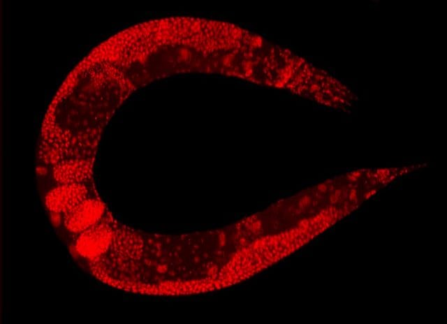 C elegans stained e1518549226740 640x464