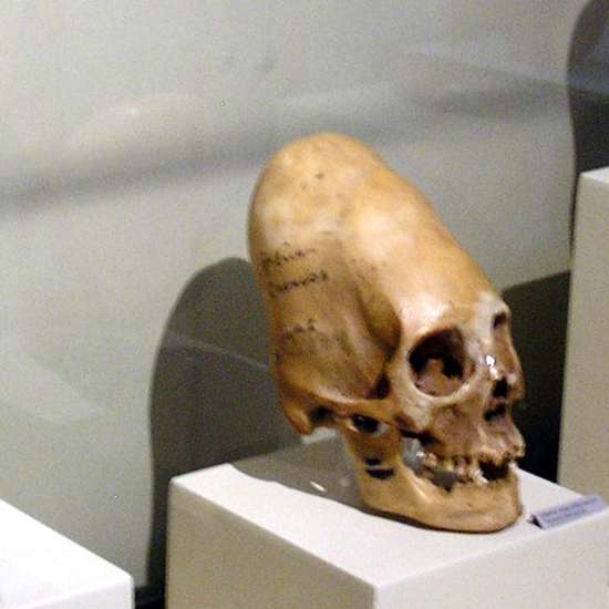New DNA Test Results on Peru’s Elongated Skulls