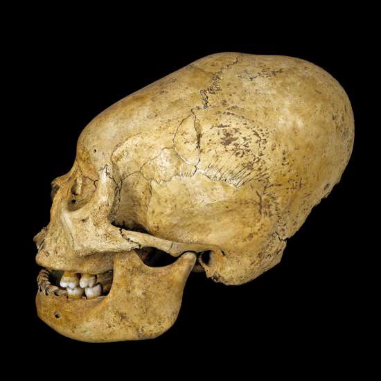 Elongated Peruvian Skulls May Have Been Elite Humans