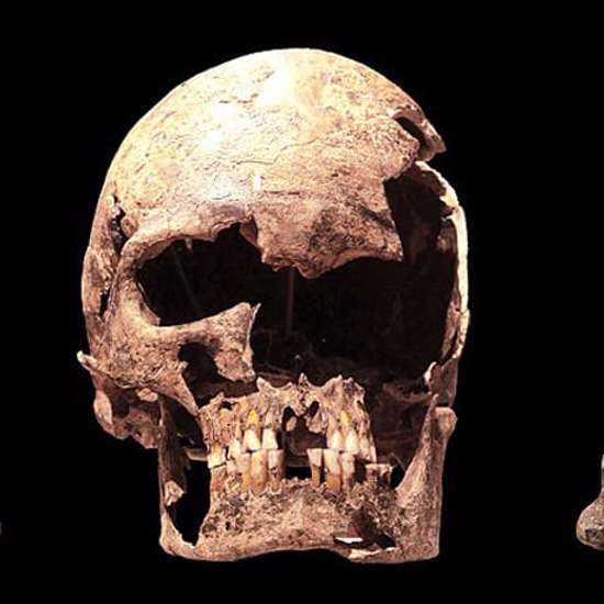 Mysterious Bavarian Elongated Skulls Are Not From Bavaria