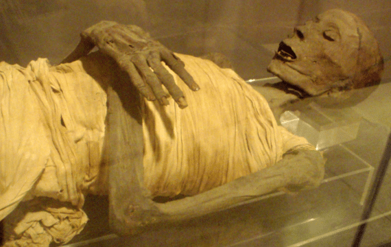 Mummy UpperClassEgyptianMale SaitePeriod RosicrucianMuseum 570x360
