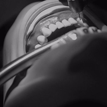 Your Dentist Can Smell Your Fear – And It Leads to Mistakes