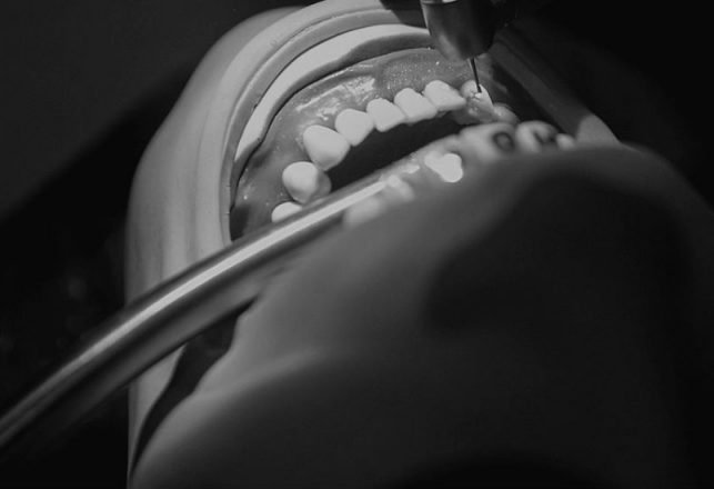 Your Dentist Can Smell Your Fear – And It Leads to Mistakes