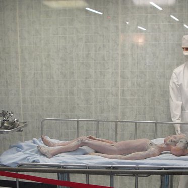 The Alien Autopsy Film: A Sci-Fi Show and Those Black Eyes