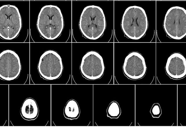 The Human Mini-Brains Are Back and They’re Better Than Before