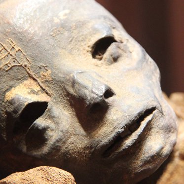 New Study Finds Ancient Mummies Had Modern Diseases