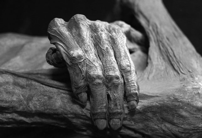 Some Odd and Spooky Cases of Cursed Mummy Hands