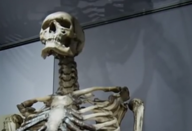 The Bizarre Mütter Museum and its Mysterious Giant Skeleton