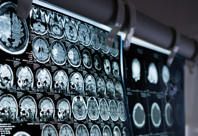 Brain Scans Identify Signals Predicting Political Preferences and Affiliations